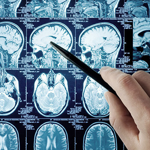 Neurochirurgia